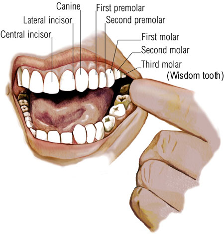 upper teeth extraction