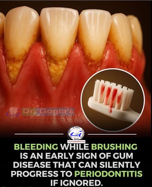 Dentist examining bleeding gums