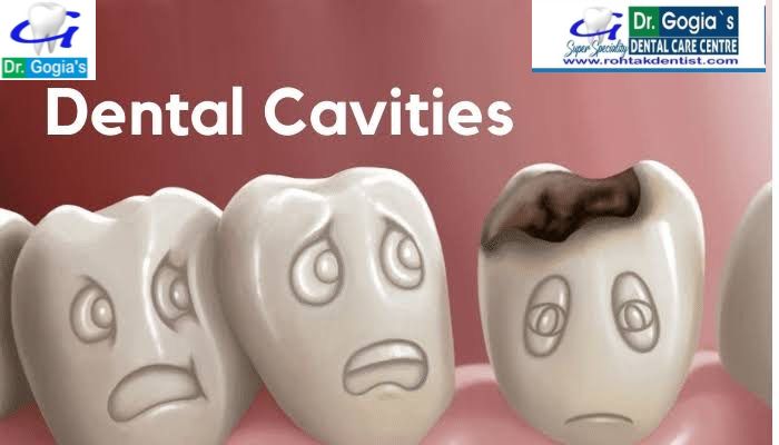 Brush Twice Daily to Prevent Dental Cavities