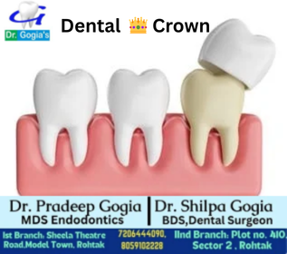 Dental Crown procedure at Dr. Gogia’s Super Specialty Dental Care Centre in Rohtak