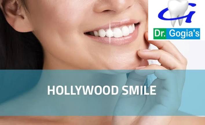 Hollywood Smile Treatment at Dr. Gogia’s Dental Care in Rohtak