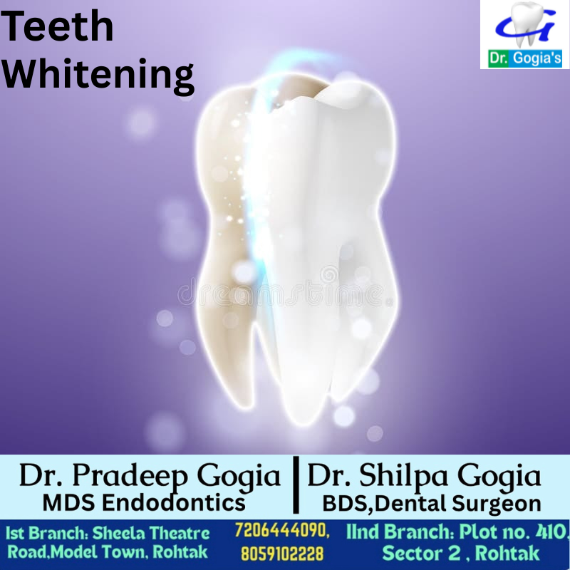 Teeth Whitening in Rohtak at Dr. Gogia’s Super Specialty Dental Care Centre – professional smile brightening treatment by expert dentists